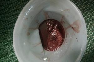 鸡西流产药流能流干净吗(鸡西人流医院最好) 鸡西流产药流能流干净吗(鸡西人流医院最好)