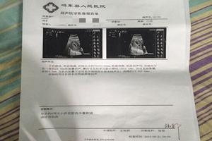 鸡西第一次怀孕 引产(引产第一胎,生第二胎好生吗) 鸡西第一次怀孕 引产(引产第一胎,生第二胎好生吗)