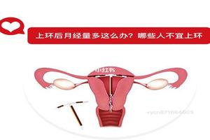鸡西环上环可以报销吗(上环费用可以报销吗)