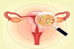 鸡西盆腔炎环上环有关系吗(盆腔炎身体里的环需不需要取了) 鸡西盆腔炎环上环有关系吗(盆腔炎身体里的环需不需要取了)